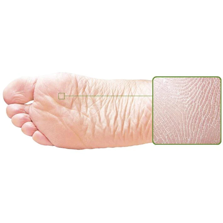 Skin Sheek Sheeky Foot™ Exfoliating Foot Peel and Callus Remover