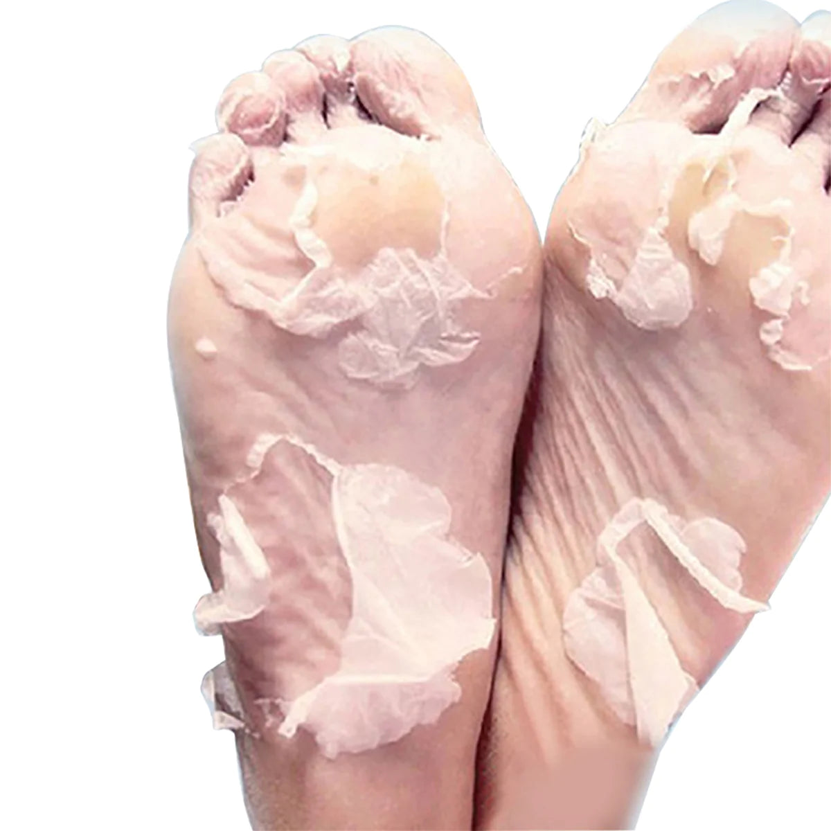 Skin Sheek Sheeky Foot™ Exfoliating Foot Peel and Callus Remover