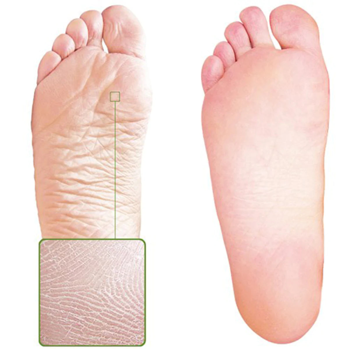 Skin Sheek Sheeky Foot™ Exfoliating Foot Peel and Callus Remover
