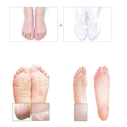 Skin Sheek Sheeky Foot™ Exfoliating Foot Peel and Callus Remover